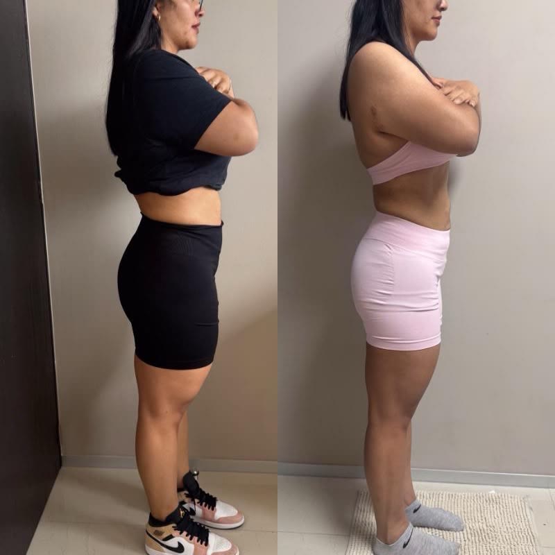 Paciente antes y después del tratamiento